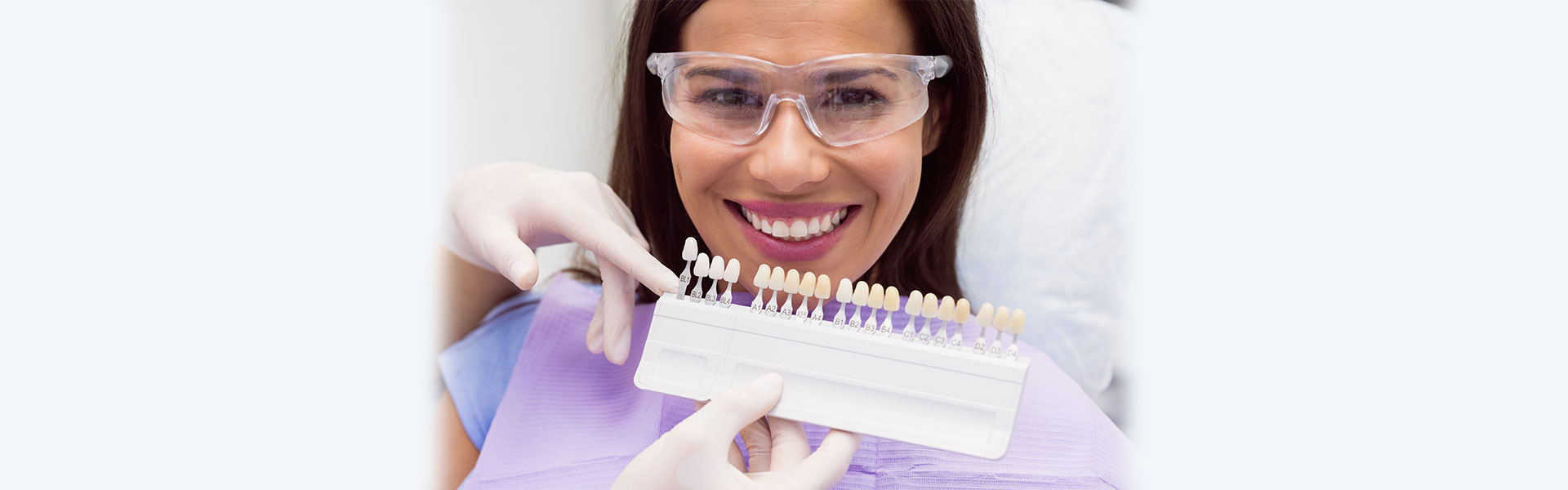 How Long Do Veneers Take from Start to Finish?