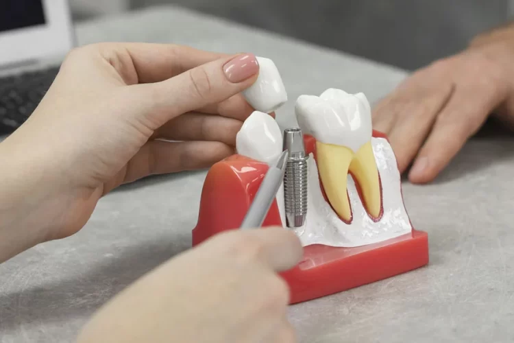 How-to-Get-Affordable-Dental-Implants-in-Temecula-Without-Sacrificing-Quality